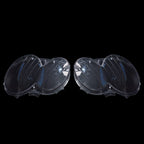 A Pair Headlight Lens Cover Clear L+R For Mercedes Benz CLK C209 W209 2005-2009